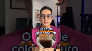 ¡Alerta! Orina color oscuro (coluria), estas son sus causas | Dr. William Guerrero #medicina #shorts