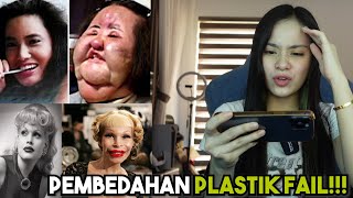 Pembedahan Plastik Yang Seram !!! Tak Sanggup Nak tengok...