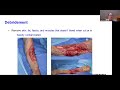 ao trauma hand must know series – how i do it – mangled hand principles and steps in the or