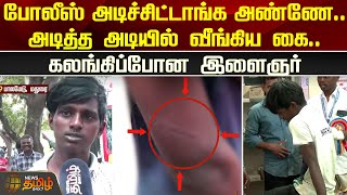 போலீஸ் அடிச்சிட்டாங்க அண்ணே...அடித்த அடியில் வீங்கிய கை...கலங்கிப்போன இளைஞர் | Palamedu Jallikattu