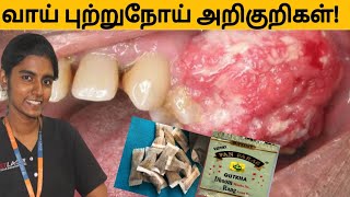 வாய் புற்றுநோய் காரணங்கள், அறிகுறிகள்,தடுக்கும் முறைகள்(Problems of cool lip, pan parag-Oral cancer)