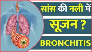 सांस की नली में सूजन हो सकता है ब्रोंकाइटिस Bronchitis | Bharat Homeo Asthma Care