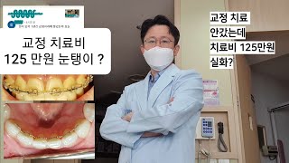 교정 치료비 125만원  눈탱이 맞은건가요?