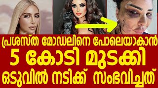 കിം കർദാഷിയനെ പോലെയാകാൻ പ്രശസ്ത നടി ചെയ്തത് | Kim kardashian | Kerala latest news #keralalive |