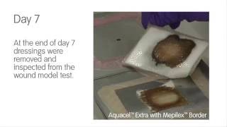 Foam Dressing Comparison   ALLEVYN Life vs MepilexTM Border with AquacelTM Extra