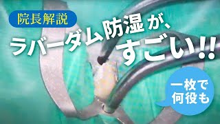 札幌市の「ユアーズデンタル クリニック」ラバーダム防湿について解説