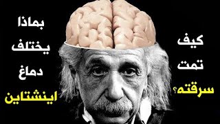 ليش اينشتاين ذكي لهالدرجة؟! 🧠 دماغه مختلف عنا !