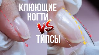 НАРАЩИВАНИЕ КЛЮЮЩИХ НОГТЕЙ НА ТИПСЫ 💅 Наращивание ногтей гелевыми типсами. ЛАЙФХАКИ маникюра