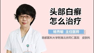 头部白癣怎么治疗 有来医生