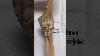 HUMAN ELBOW JOINT | Anatomy | Surgery | #medical animation  #anatomy