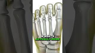 Do Bunion Correctors Work? [How to shrink bunions naturally!]