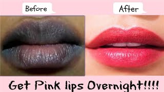 Japanese Secret 🌞 Get Pink Lips Naturally At Home Permanently | 100% Works At Home