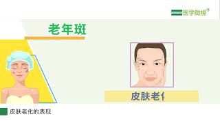 黄褐斑、雀斑、老年斑、颧部褐青色痣发生的原因是什么？