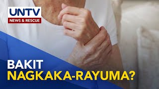 Mga dapat malaman hinggil sa Arthritis o Rayuma | Now You Know