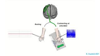 Cortical Silent Period (cSP) Overview