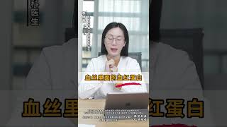 脸上有红血丝 用什么药可以清除？ #红血丝  #健康科普在快手  #皮肤健康看快手