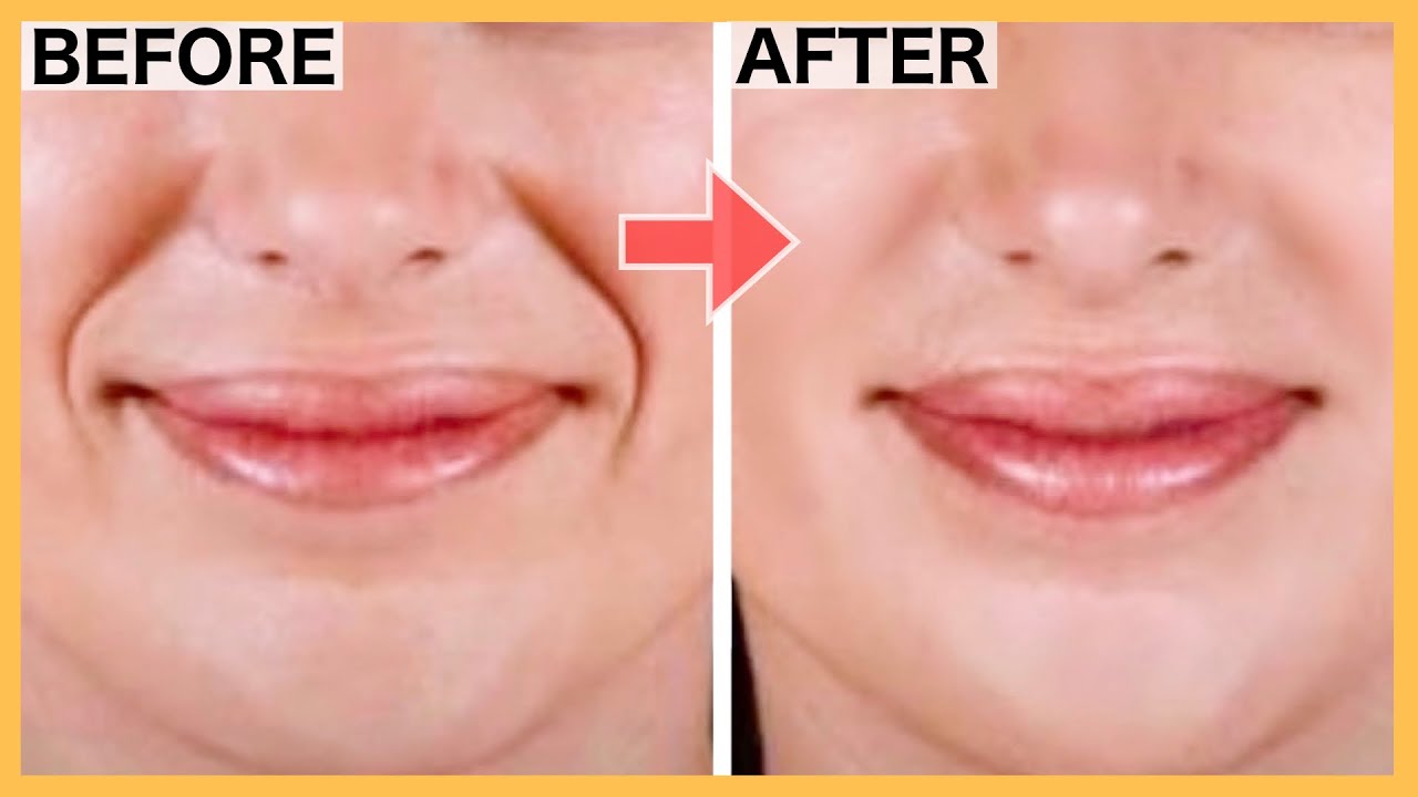 SMILE LINES Facial Exercises (Nasolabial Folds/ Laugh Lines) | Lift ...