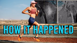 How I got Injured | Stress Fractures | Road to Recovery