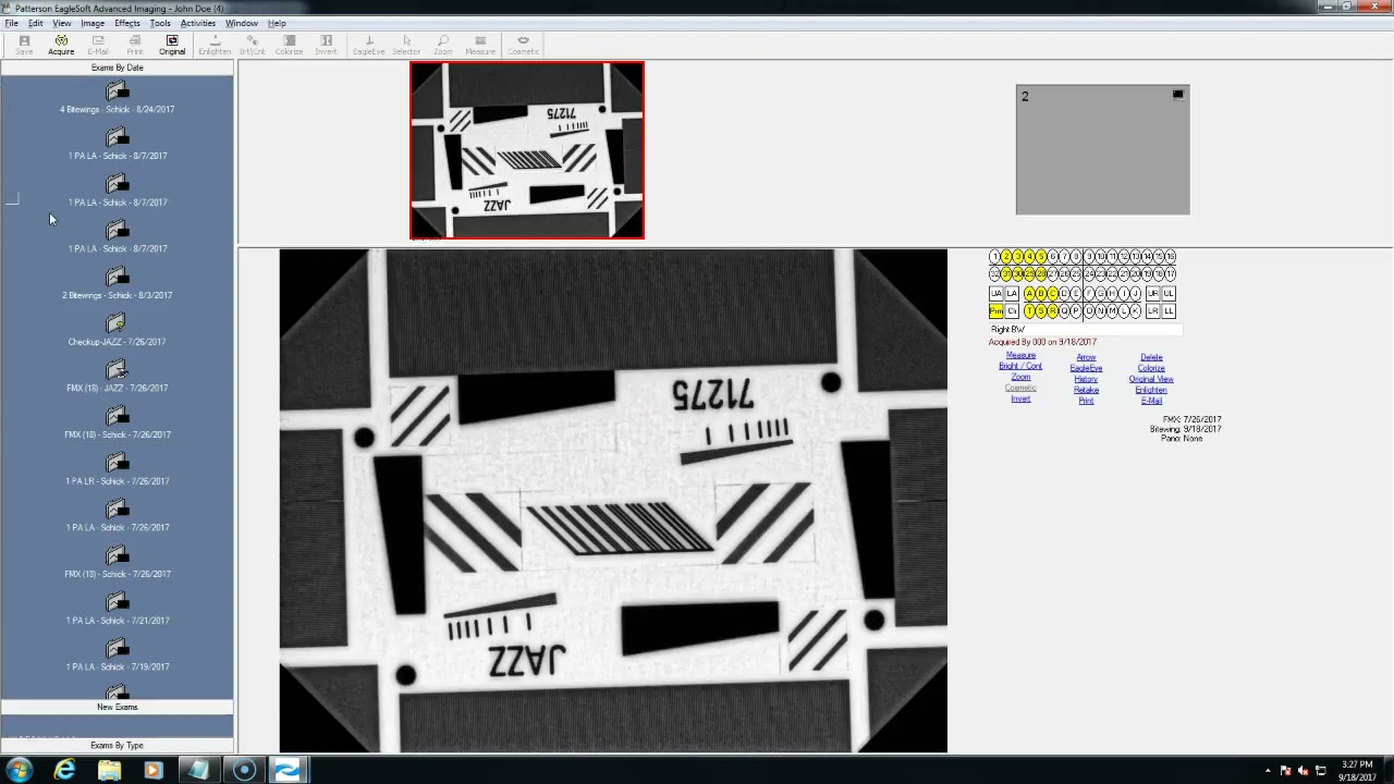 Eaglesoft Demo Youtube