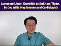 lunas sa ulcer gastritis at sakit sa tiyan. by doc willie ong internist and cardiologist