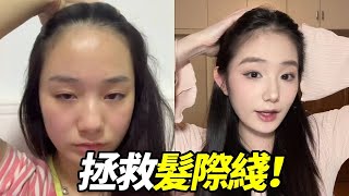 拥有胎毛刘海的快乐谁懂啊！大家一直问的发际线来咯！#妆前妆后 #发际线 #脱发 #脱发改善 #拯救发际线 #美女 #方圆脸 #makeup