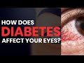 How Diabetes Affects the Eyes