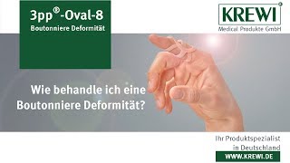 Wie behandle ich eine Boutonniere Deformität? | 3pp Oval-8 | KREWI® Medical Produkte GmbH