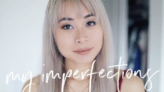 My Perfect Imperfections Tag | Biggest Flaws \u0026 Insecurities