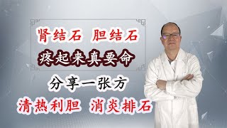 肾结石、胆结石，疼起来真要命，分享一张方，消热利胆、消炎排石