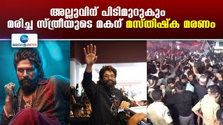 Allu Arjun Case Sritej Health | അല്ലുവിന് പിടിമുറുകും, മരിച്ച സ്ത്രീയുടെ മകന് മസ്തിഷ്ക മരണം