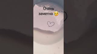 дасматри да канса 😅