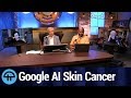 Google Uses AI to Diagnose Skin Cancer