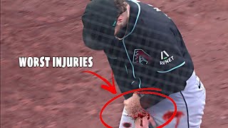 MLB• Worst Injuries Part1