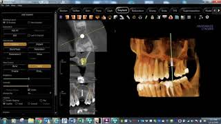 Integrating your Intraoral Scanner with KaVo™ and i-CAT™