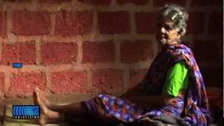 List Of Endosulfan Victims Who Deserve Fund Is Cut Short