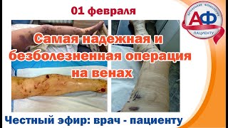 Самая надежная и безболезненная операция на венах