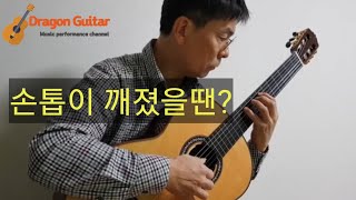 [자막있슴][ENG SUB]클래식 기타를 치는데 손톱이 부러졌어요! (알래스카 핑거 피크 + 탁구공붙이기)