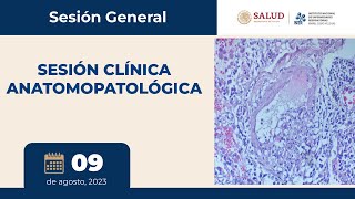 SESIÓN GENERAL: SESIÓN CLÍNICA ANATOMOPATOLÓGICA, INER