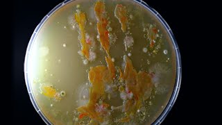 Dirty Hand Bacteria Time-Lapse