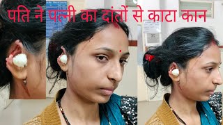 Bhind fast News: भिंड के हीरालाल के पुरा में पति ने पत्नी का दांतों से कांटा कान #Bhind #mp #news