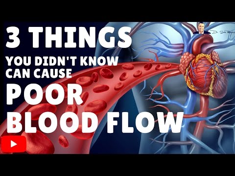 → 3 Things You Didn’t Know Can Cause Poor Blood Flow & Circulation → 3 Things You Didn’t Know Can Cause Poor Blood Flow & Circulation