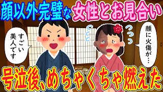 【2ch 馴れ初め】顔に酷い火傷がある女性とお見合い→女性「こんな顔嫌いですよね」俺「世界一美人です！」号泣後、めちゃくちゃ燃えた【ゆっくり解説】