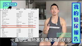 我的驗尿報告（結石 血尿 尿道炎）