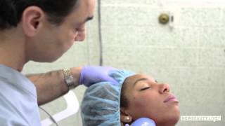 Stop Aging Skin With Clear + Brilliant Laser Treatment