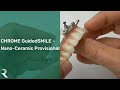 CHROME GuidedSMILE - CHROME Provisional