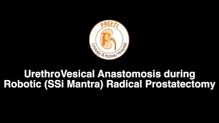 UrethroVesical Anastomosis during Robotic (SSi Mantra) Radical Prostatectomy