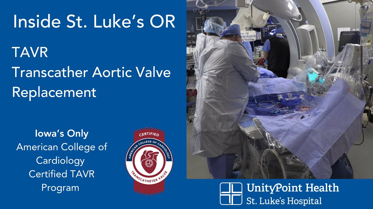 View Transcatheter Aortic Valve Replacement Tavr Procedure Youtube