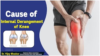 Internal Derangement of Knee _ Causes and Treatment || Dr. Vijay Bhaskar || Socialpost Healthcare