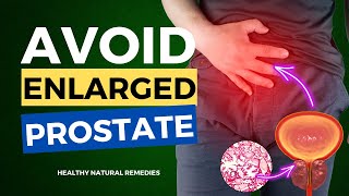 8 Worst Foods To Avoid Enlarged Prostate