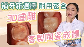 為什麼要做3D齒雕？｜台中牙科陳怡蓉醫師小學堂EP.5 重新打造您的牙齒，不破壞真牙結構｜精緻3D齒雕 #3D齒雕 #台中牙醫